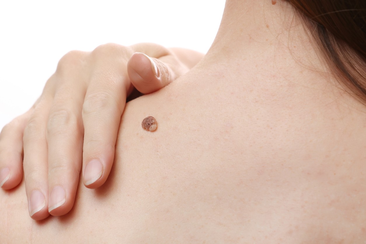 https://www.northstardermatology.com/southlake/cosmetic-services/
