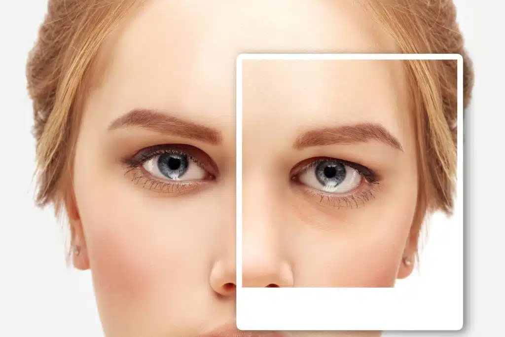 schedule eyelid surgery in kansas city
