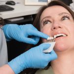 How Fluoride Remineralisation Works at the Molecular Level to Reverse Early Decay